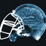 brain-injury-football-340x272-150x150